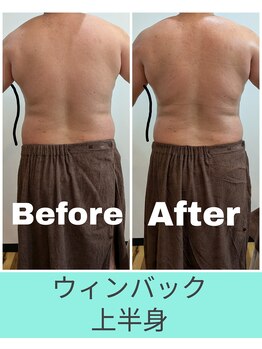 エミナル(EMINAL)/60分のウィンバック効果 脇腹