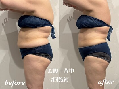 スキンスタジオ レア(Lea)の写真