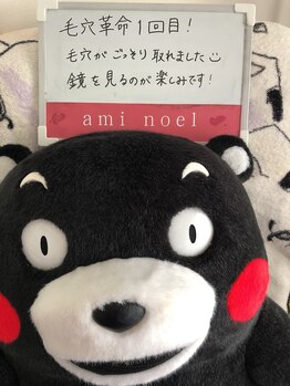 アミノエル/毛穴/ニキビケア/赤ら顔