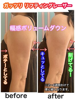 ビューティ ウィッチ(Beauty Witch)/