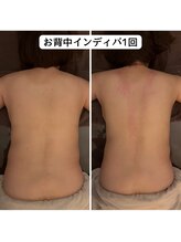 ランネル(Runnel)/インディバビフォーアフター