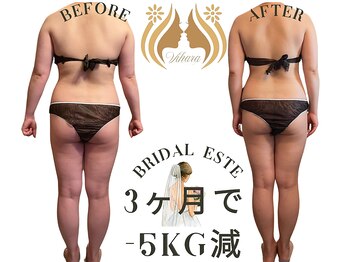 ビハーラ 門司店/3ヶ月で結果出し痩身エステ/門司