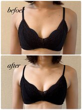 シャルマン(Charmant)/befoer、after