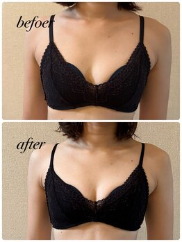 シャルマン(Charmant)/befoer、after