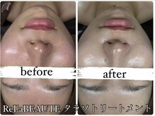 ビノスビューティー(vinos.beauty)/ReLABEAUTEタラソトリートメント