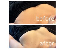 ドゥブレジャンティ(doubler gentil)の雰囲気（ふんわり美バストメイク（１回）　サイズアップは6回の継続を♪）