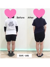 こんだ整骨院/O脚改善ビフォーアフター