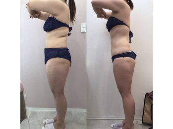 リラパドマ 千葉店(Rela Padma)/激痩せ短期集中ダイエットコース