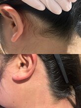 ユウユウ(YUYU)/アップスタイルも怖くない！