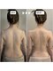 オーラリッチ(ORARICH)の写真/固くなった脂肪セルライトをほぐしながら吸引！全身引き締め＆サイズダウン♪