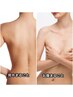 【 Ladies'★ 自信が持てる素肌に！】背中 or お腹まるごと脱毛♪