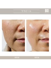 カリスボーテ 関本店/ララピール