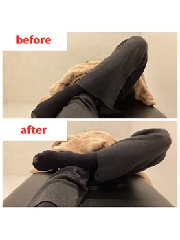 ナオル整体 福岡香椎院(NAORU整体)/40代女性施術事例【股関節】