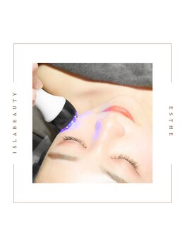 アイラビューティ エステ 中目黒(ISLA BEAUTY)/《小顔へ》【ハイパーナイフ】