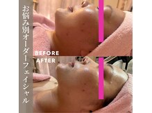 ポムポムボナーの雰囲気（関ICから7分「マクドナルド」様がある通りにある緑のお家です。）