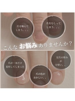 ココ ネイル サロン アンドスクール(COCO.NAIL SALON&SCHOOL)/爪噛みでお悩みのあなたへ