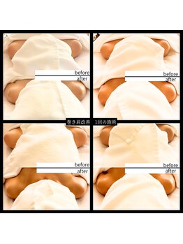 リンパ専門店 ファリンソ/巻き肩矯正+リンパボディ&ベッド