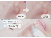 ベル 堀江(Belle)の雰囲気（【透明感美肌】ハーブピーリング&毛穴洗浄でうるツヤ透明肌へ☆）