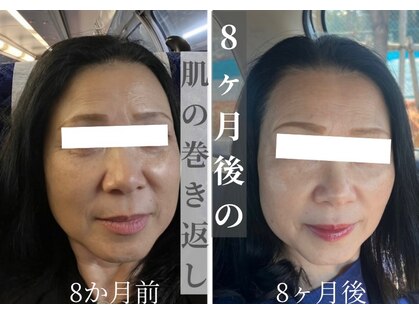 シャイネル(SHYNELL)の写真