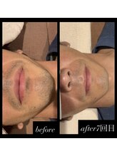 メンズスタイル(MEN'S STYLE)/