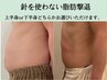 【夏前駆け込み！◆残り5名】上半身or下半身/針を使わない脂肪分解&ラジオ波