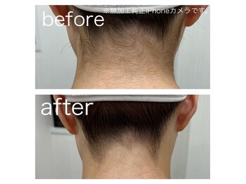 ラクシー 北千住(luxssy)/うなじシェービング