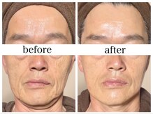 アリエス/小顔リンパマッサージ