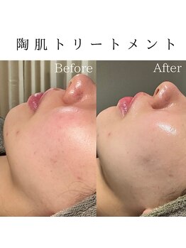 ビューティービューティー(BEAUTY BEAUTY)/