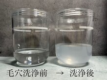 ビューティトリップ(Beauty TRIP)/毛穴洗浄で顔も頭皮も清潔に