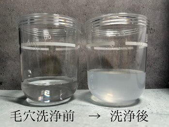 ビューティトリップ(Beauty TRIP)/毛穴洗浄で顔も頭皮も清潔に