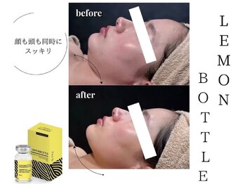ロゼッティ(ROSETTY)/レモンボトル　フェイスライン