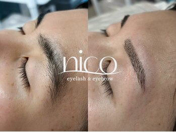 ニコ(nico)/メンズ眉ワックス脱毛