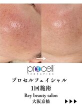 レイ(Rey)/プロセル1回の変化