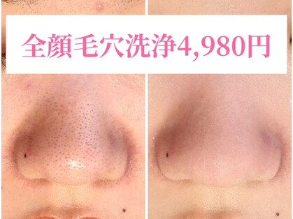 アイリーン(IRENE)の写真