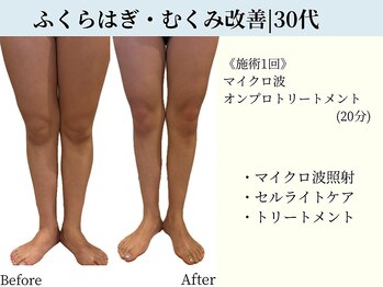 京都フォーエイチ(京都4H)/むくみゼロ！華奢なふくらはぎに
