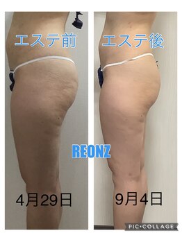 リオンズ 茨城ミスターマックス取手店/3ヶ月でこの結果♪【痩身】