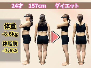 ほんじょう整骨院 美容整体/北九州/八幡西区/ダイエット