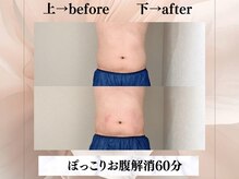 イヨヨ(iyoyo)/【痩身】Before After