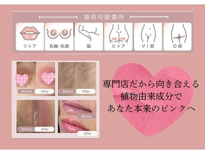 ラヌイ(LANUI)の写真