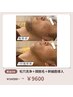 【男女OK☆脱毛後の乾燥防止】鼻毛穴洗浄+顔脱毛+幹細胞導入¥14500→¥9600