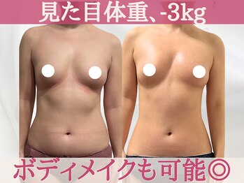 キャンベル(CANBELLE)の写真/【骨格から美ボディへ】全身の歪みをリセットし理想のメリハリ体型へ◎