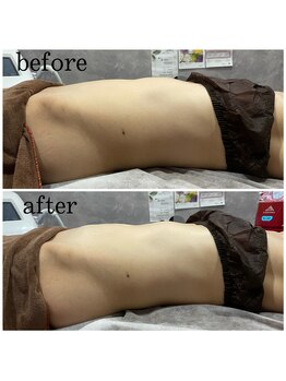 サロン ラズリ 久留米店(SALON Lazuli)/【痩身】マッサージみたいな体感