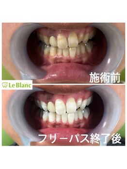 ルブラン 奈良店(Le Blanc)/通いやすいサロン!