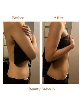 エードット 銀座(A.)/before → after