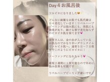 リエイド(Re AID)/5日後はピカピカなタマゴ肌が！