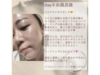 リエイド(Re AID)/5日後はピカピカなタマゴ肌が!