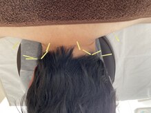 あゆみボディケア鍼灸整体院/肩こり改善！