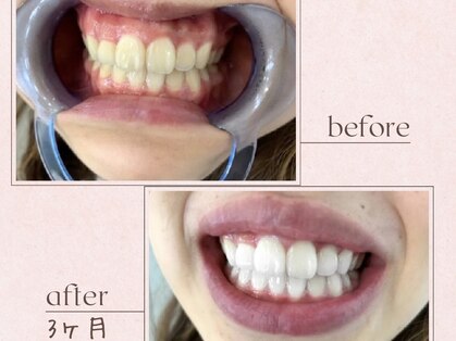 ルアナシンフォニア エクシア 東銀座店(Luana-Sinfonia)の写真