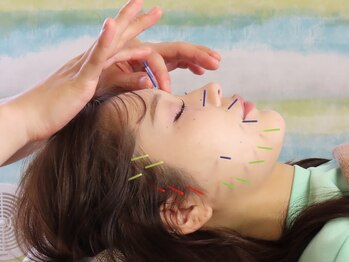 ハウオラ 三軒茶屋(HAUOLA)/施術【美容鍼/小顔/むくみ】