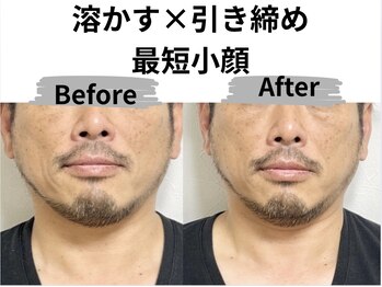 マリア(MALIA)/余白、溶かす。輪郭を魅せる